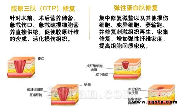 弹性蛋白肽CTP胶原蛋白肽营养粉效果好吗？